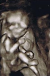 15週の赤ちゃん。右手の人差し指がはっきり！
※画像はすべて4Dエコーによるものです。