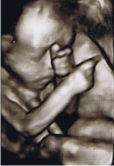 22週。ほおがふくっらして、赤ちゃんらしい顔つきに。何かを考え込んでいるみたいです…。